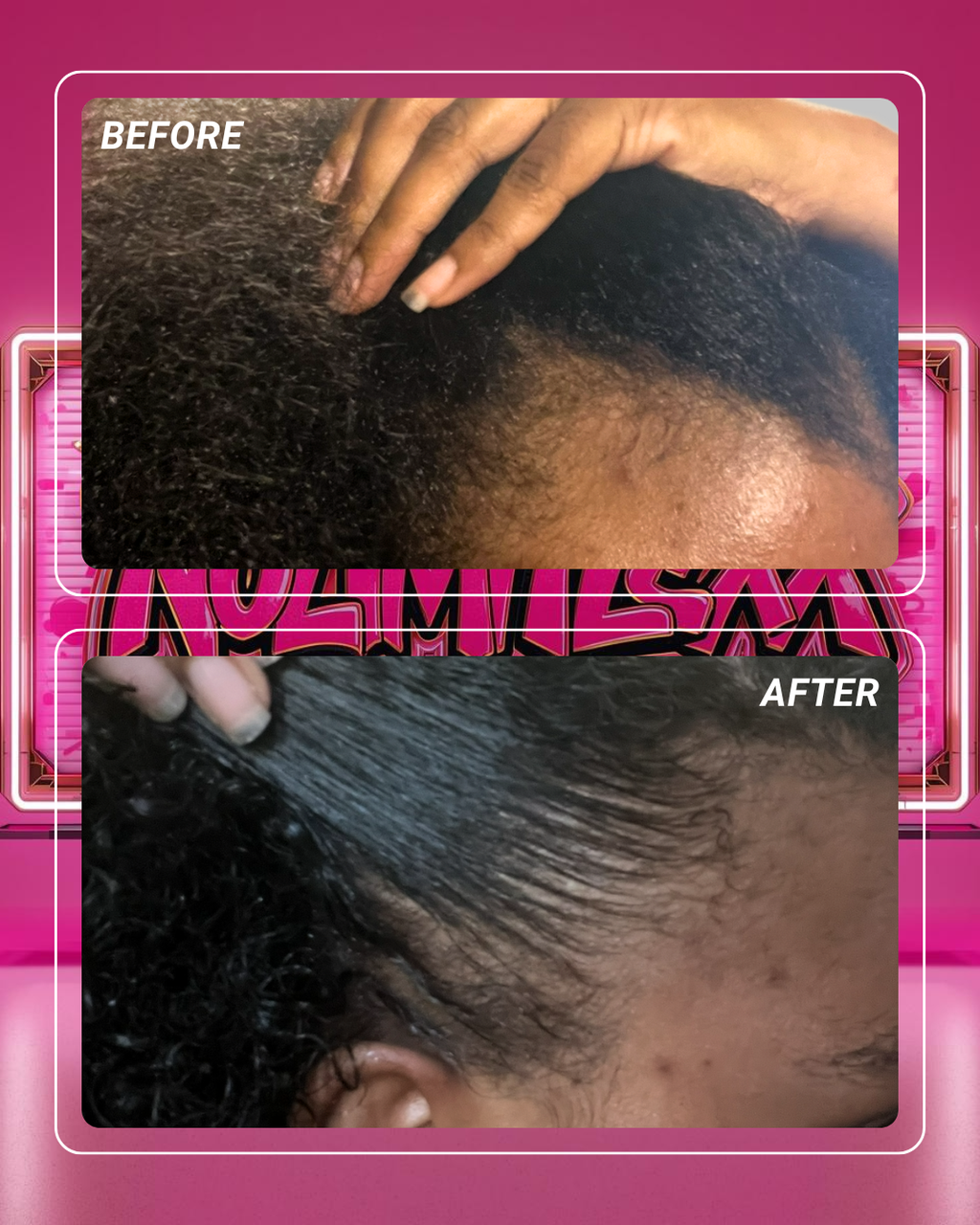 Crowned Curl Evolution